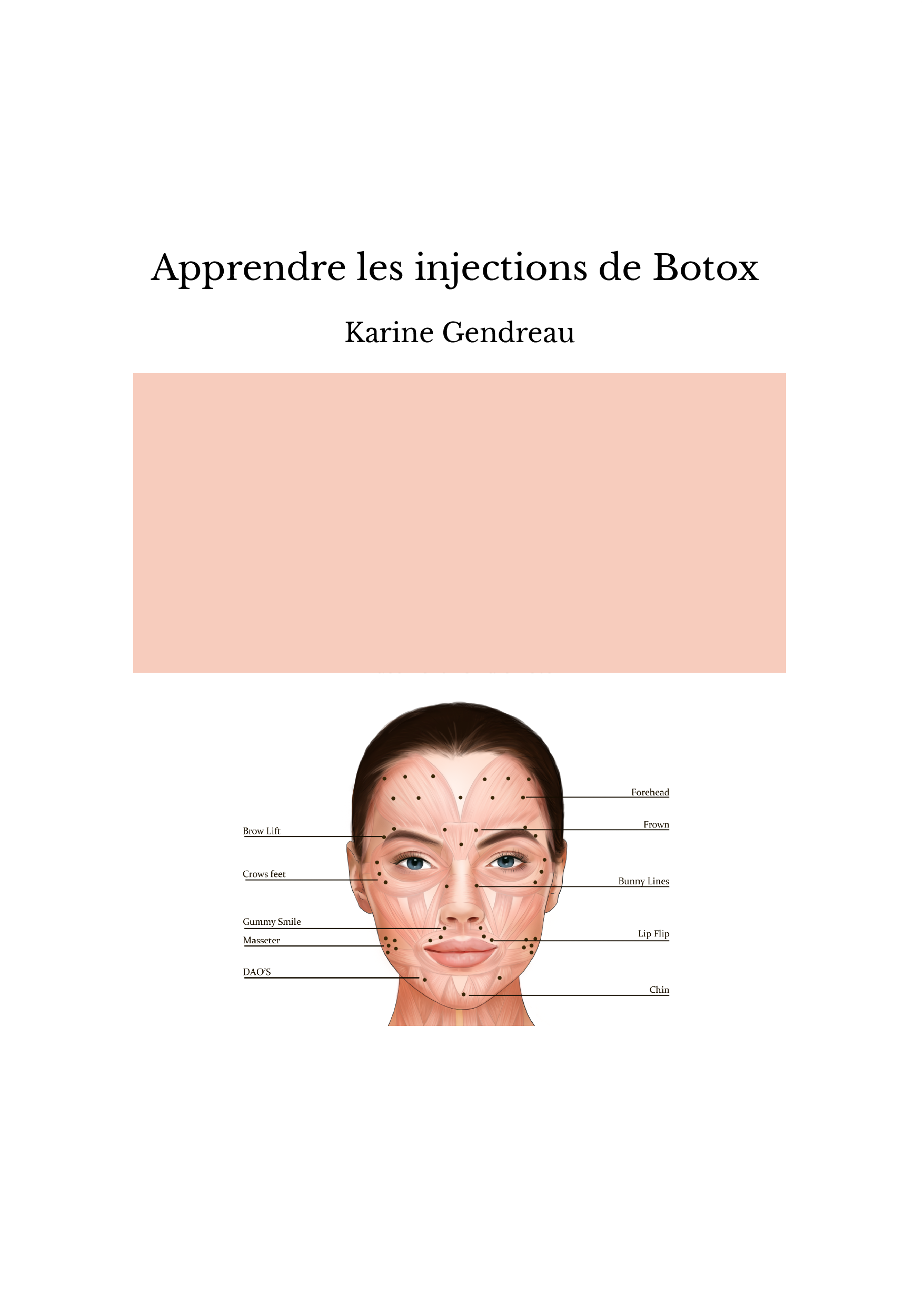 Apprendre les injections de Botox 